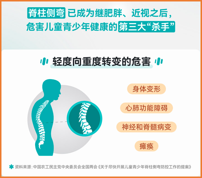 脊柱側(cè)彎